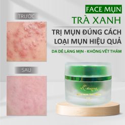 Kem Face Giảm Mụn Tinh Chất Trà Xanh N Collagen - 8938526572300