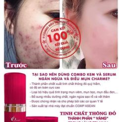 Serum Mụn Hàn Quốc Charme Anti Acne 15ml - 8809273480227