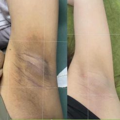 Kem Giảm Thâm Nách Q Nic Care Thái Lan Phiên Bản Mới - QNIC01