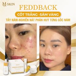 Combo Kem Face Sâm Vàng MQ Skin - CBFACEMQSKIN01