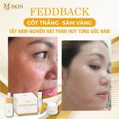 Combo Kem Face Sâm Vàng MQ Skin - CBFACEMQSKIN01