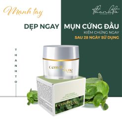 Kem Face Mụn Rau Má Jiuhe Centella Acne Thanh Tô Cosmetics 10g - FACEMUNJIUHE