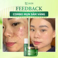 Combo Cao Mụn Sâm Vàng MQ Skin - CBCAOMUNMQ
