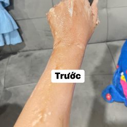 Kem Peel Men Lột Lạnh Collagen Nicolas Cosmetic - LOTLANHNICOLAS