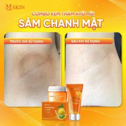 Combo Kem Tẩy Lông + Kem Thâm Nách MQ Skin Sâm Chanh Mật - 8936117150241