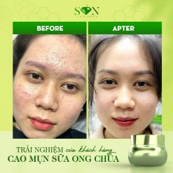Combo Kem Face Cao Mụn Sữa Ong Chúa + Kem Face Xanh Mụn Thâm SON Cosmetic - COMBOSON10