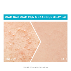 Serum Garnier Giảm Mụn Sáng Da Skin Naturals Bright Complete Anti-Acne Booster Serum 30ml - 8994993018390