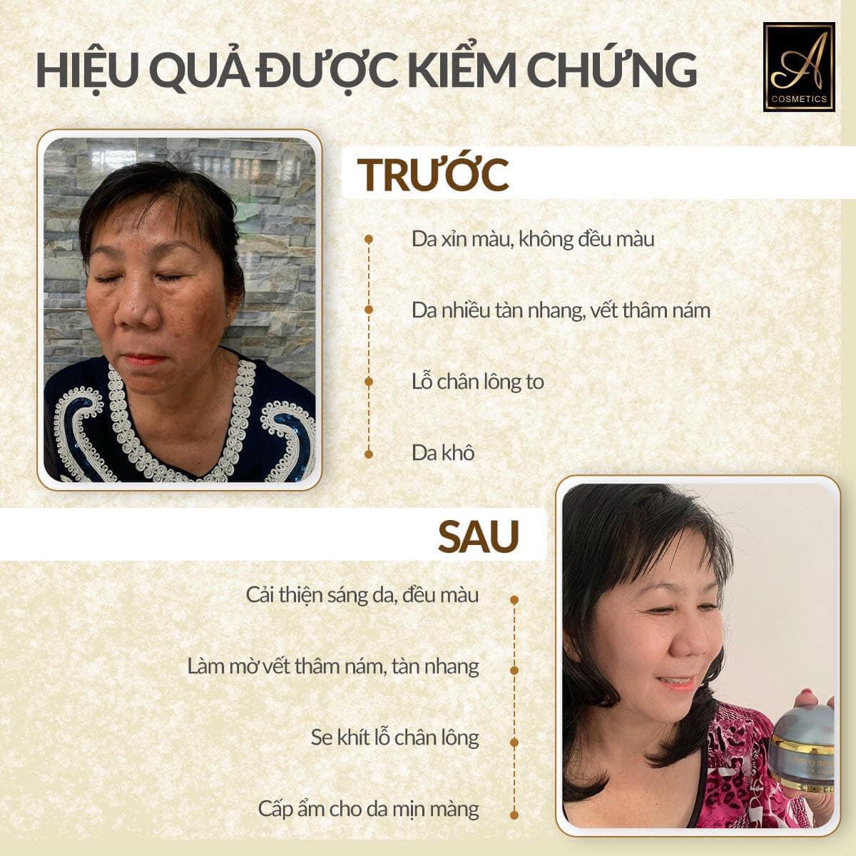 Khám Phá Bí Quyết Làm Mờ Vết Nám với Kem Nám Nhân Sâm Ginseng Melasma Khám Phá Bí Quyết Làm Mờ Vết Nám với Kem Nám Nhân Sâm Ginseng Melasma