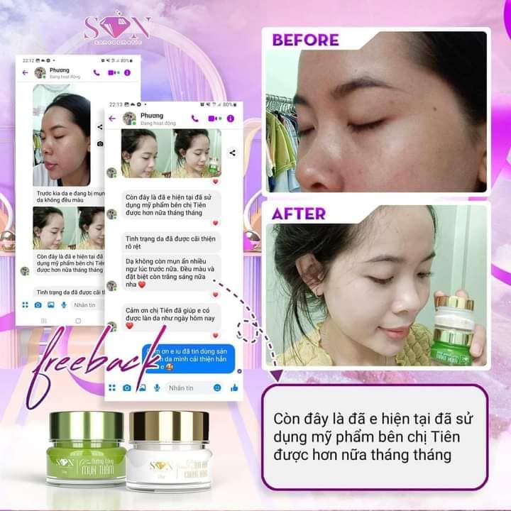 Combo Kem Dưỡng Trắng Da, Giảm Mụn son Cosmetic Tặng Kèm Cao Bưởi Loại Bỏ Thâm Sạm Se Khít Lỗ Chân Lông Combo Kem Dưỡng Trắng Da, Giảm Mụn son Cosmetic Tặng Kèm Cao Bưởi Loại Bỏ Thâm Sạm Se Khít Lỗ Chân Lông