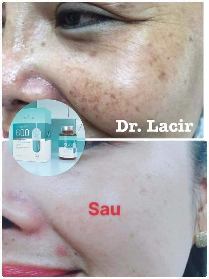 Viên Uống Trắng Da Glutathione 600 Dr Lacir Viên Uống Trắng Da Glutathione 600 Dr Lacir