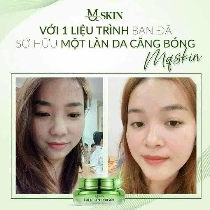 Kem Face Tái Tạo Nội Sinh Exfoliant Cream MQ Skin Kem Face Tái Tạo Nội Sinh Exfoliant Cream MQ Skin