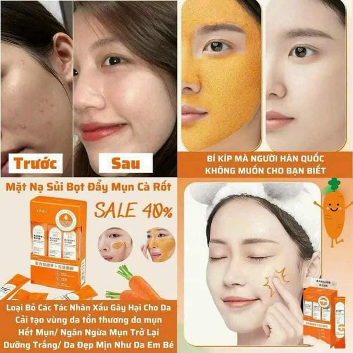 Hộp 12 Mặt Nạ Cà Rốt Sủi Bọt YanFu Hộp 12 Mặt Nạ Cà Rốt Sủi Bọt YanFu