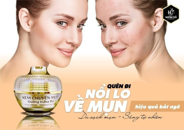 Kem Face Chuyên Nám Huỳnh Đỗ Melasma Cream Kem Face Chuyên Nám Huỳnh Đỗ Melasma Cream
