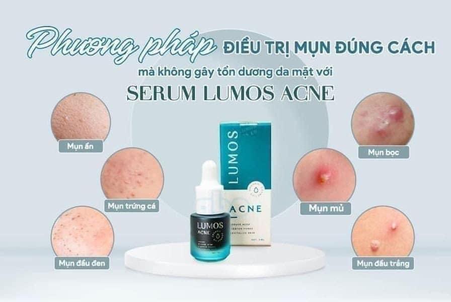 Serum trị mụn Lumos mẫu mới Chưa 1 dòng trị mụn nào qua được e luôn Serum trị mụn Lumos mẫu mới Chưa 1 dòng trị mụn nào qua được e luôn