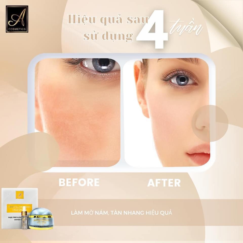 Tạm Biệt Nám Sạm Với Kem Nám Nhân Sâm Dưỡng Trắng Tạm Biệt Nám Sạm Với Kem Nám Nhân Sâm Dưỡng Trắng