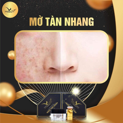 Kem Face VIP White da trắng hồng bật tông không hề khó Kem Face VIP White da trắng hồng bật tông không hề khó