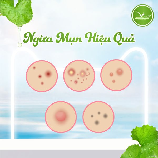 Sữa rửa mặt rau củ công nghệ Hàn Quốc của nhà Vip White Sữa rửa mặt rau củ công nghệ Hàn Quốc của nhà Vip White