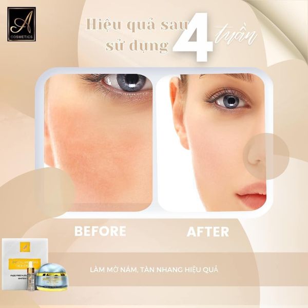 Face Serum Nám Nhân Sâm A Cosmetics Ginseng Melasma Mỹ Phẩm Phương Anh Face Serum Nám Nhân Sâm A Cosmetics Ginseng Melasma Mỹ Phẩm Phương Anh