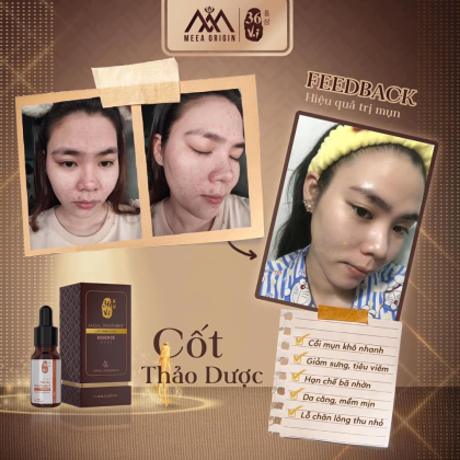Serum Cốt Huyết Thanh Thảo Dược 36 Vị Full 10ml MeeA Origin chính hãng Serum Cốt Huyết Thanh Thảo Dược 36 Vị Full 10ml MeeA Origin chính hãng