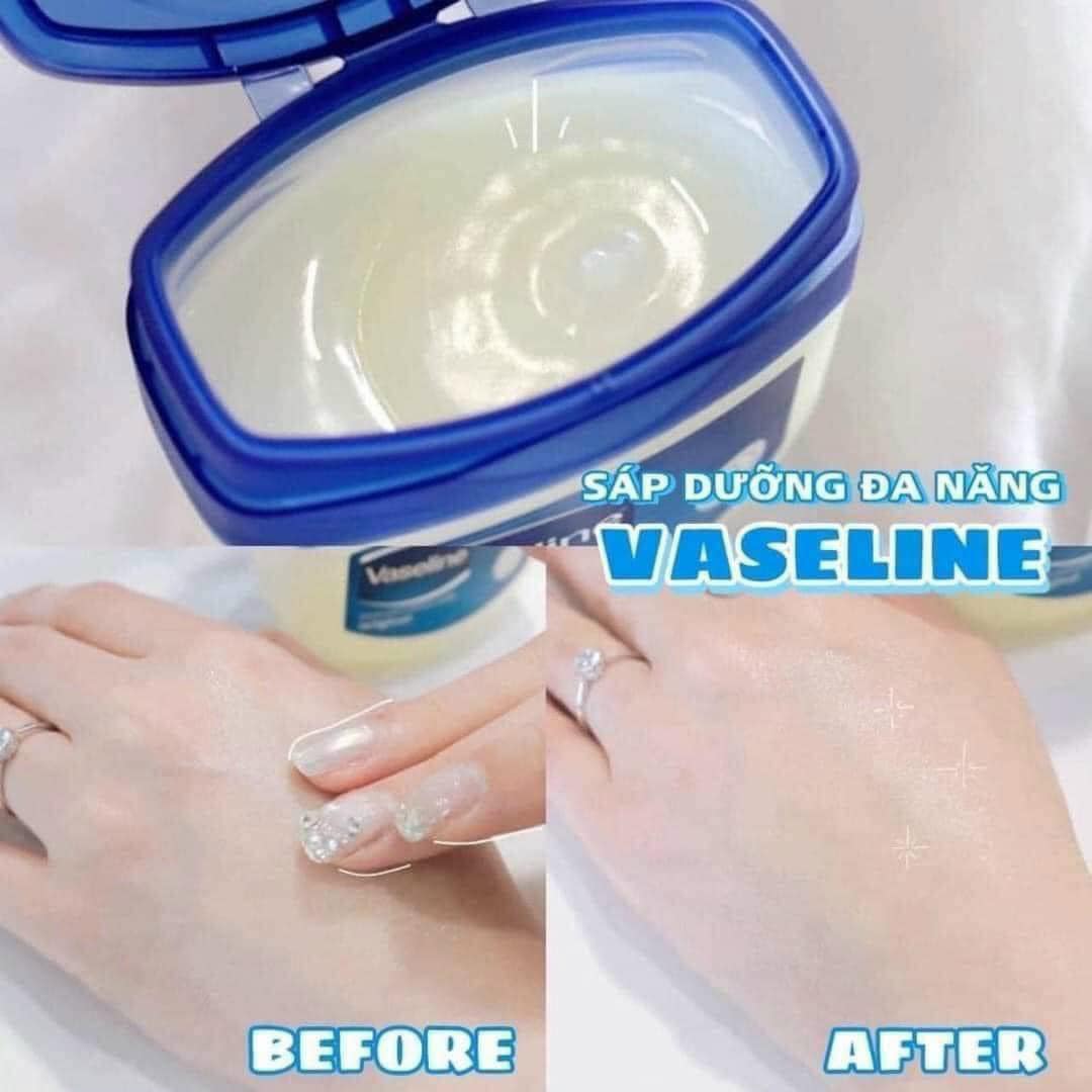 sáp dưỡng Vaseline với nhiều công dụng sáp dưỡng Vaseline với nhiều công dụng