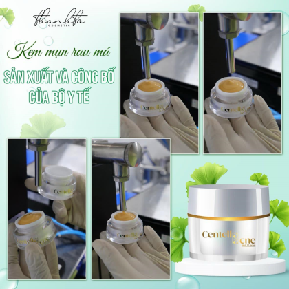 Kem Face Mụn Rau Má Jiuhe Centella Acne Thanh Tô Cosmetics 10g chính hãng Kem Face Mụn Rau Má Jiuhe Centella Acne Thanh Tô Cosmetics 10g chính hãng