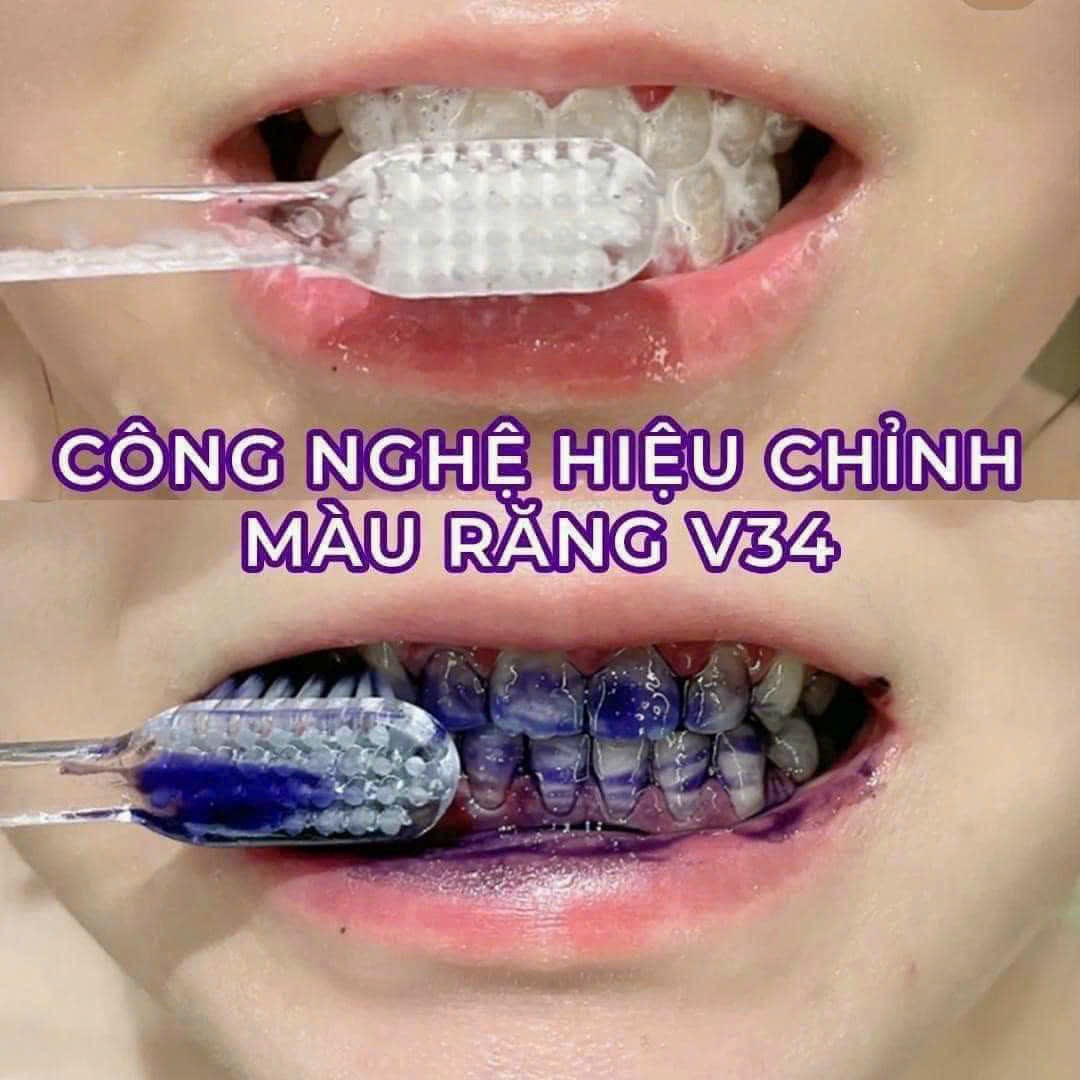 Serum Trắng Răng Unismile, Hỗ Trợ Cải Thiện Vết Ố Vàng Unikare Serum Trắng Răng Unismile, Hỗ Trợ Cải Thiện Vết Ố Vàng Unikare