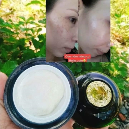 Cao Nám Balla Luta Lớn 30g chính hãng Cao Nám Balla Luta Lớn 30g chính hãng