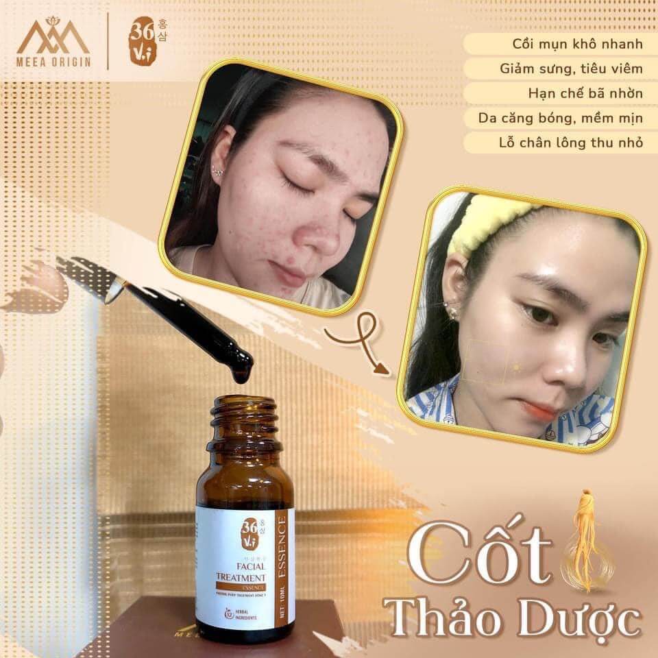 Serum Cốt Huyết Thanh Thảo Dược 36 Vị Full 10ml MeeA Origin Serum Cốt Huyết Thanh Thảo Dược 36 Vị Full 10ml MeeA Origin