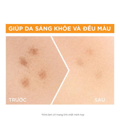 Tinh Chất Garnier Tăng Cường Sáng Da Mờ Thâm Bright Complete 30x Vitamin C Booster Serum 30ml Tinh Chất Garnier Tăng Cường Sáng Da Mờ Thâm Bright Complete 30x Vitamin C Booster Serum 30ml