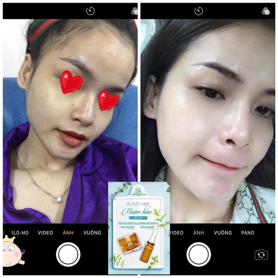 Combo dưỡng da, phục hồi hư tổn da (gồm Kem face Collagen x3 và Serum Collagen x3)