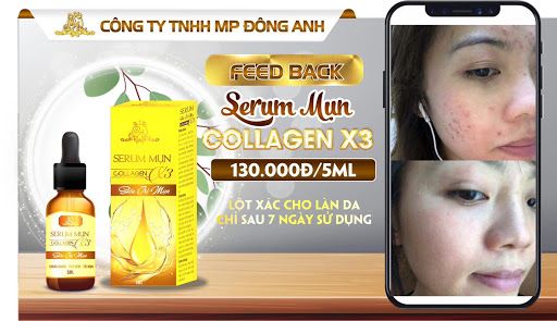 Serum trị mụn Collagen X3 chính hãng Mỹ Phẩm Đông Anh Serum trị mụn Collagen X3 chính hãng Mỹ Phẩm Đông Anh