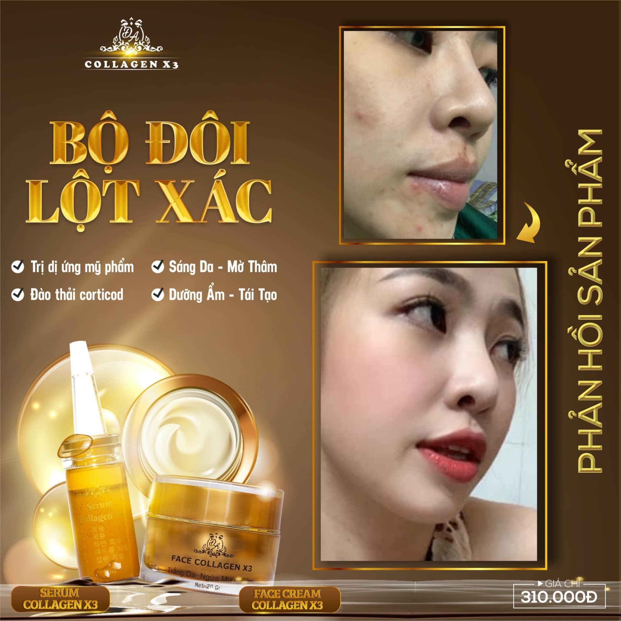 Combo Duỡng Da Trị Nám + Chống nắng Nọc Ong Collagen X3 Combo Duỡng Da Trị Nám + Chống nắng Nọc Ong Collagen X3