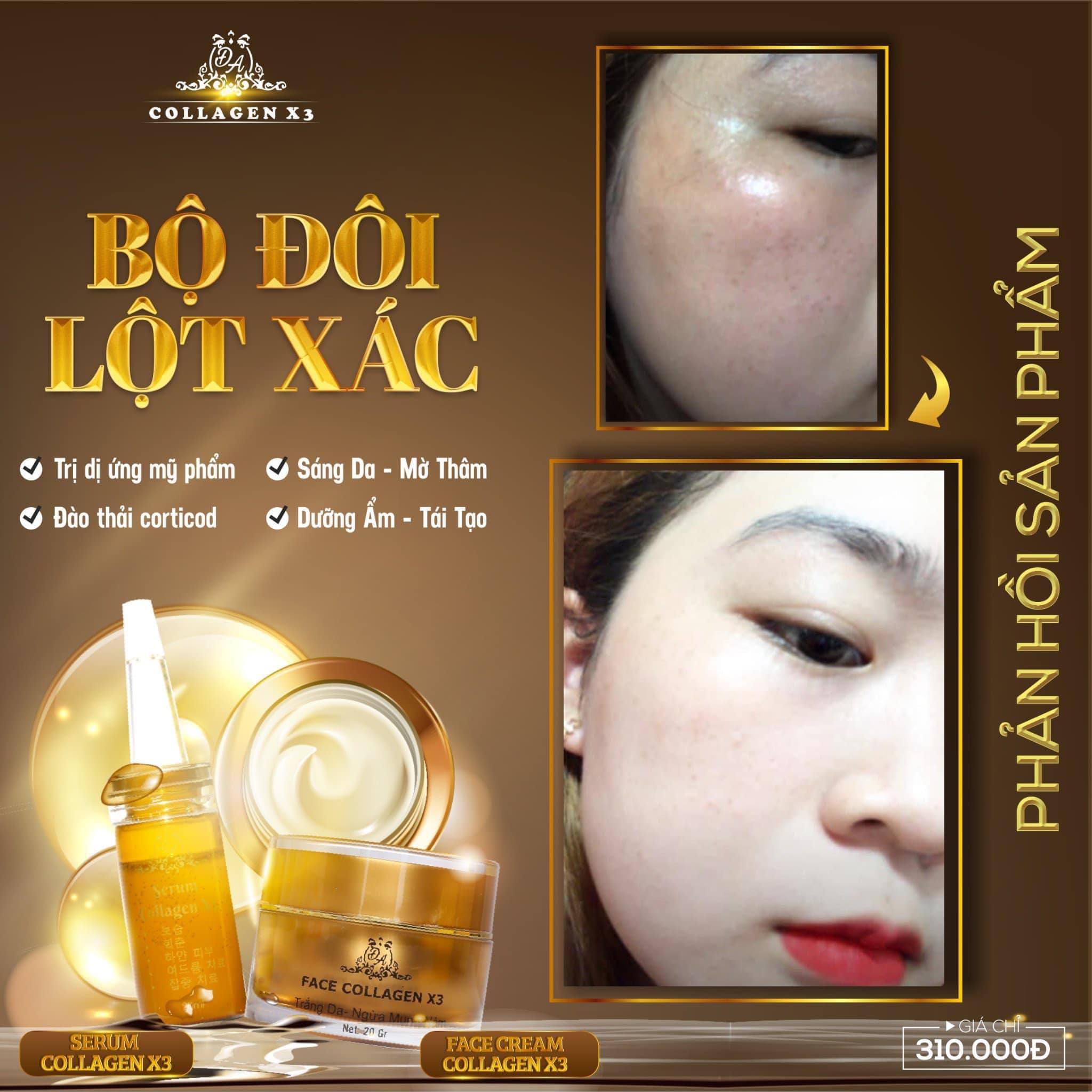 Combo Duỡng Da Trị Nám + Chống nắng Nọc Ong Collagen X3 Combo Duỡng Da Trị Nám + Chống nắng Nọc Ong Collagen X3