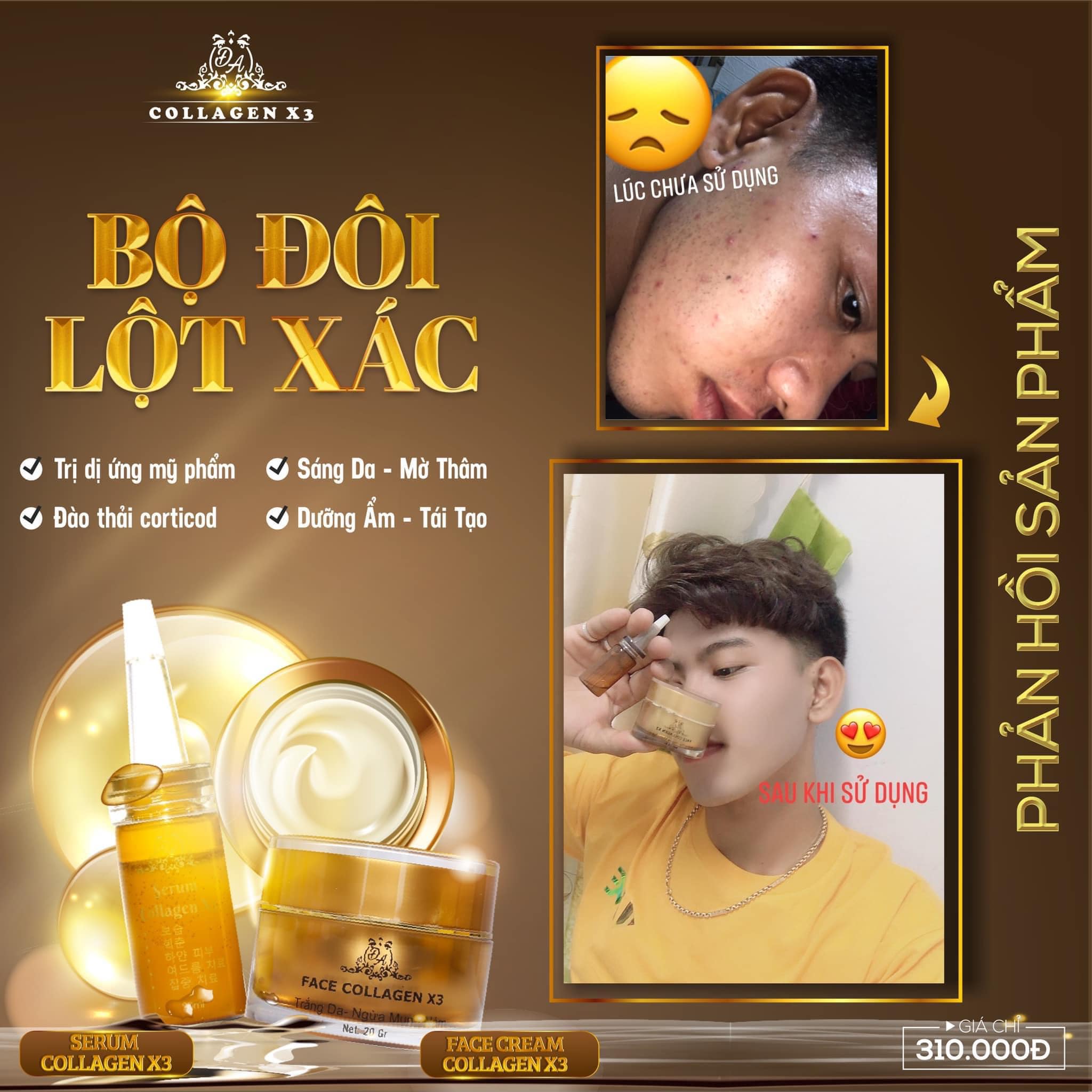 Combo Duỡng Da Trị Nám + Chống nắng Nọc Ong Collagen X3 Combo Duỡng Da Trị Nám + Chống nắng Nọc Ong Collagen X3