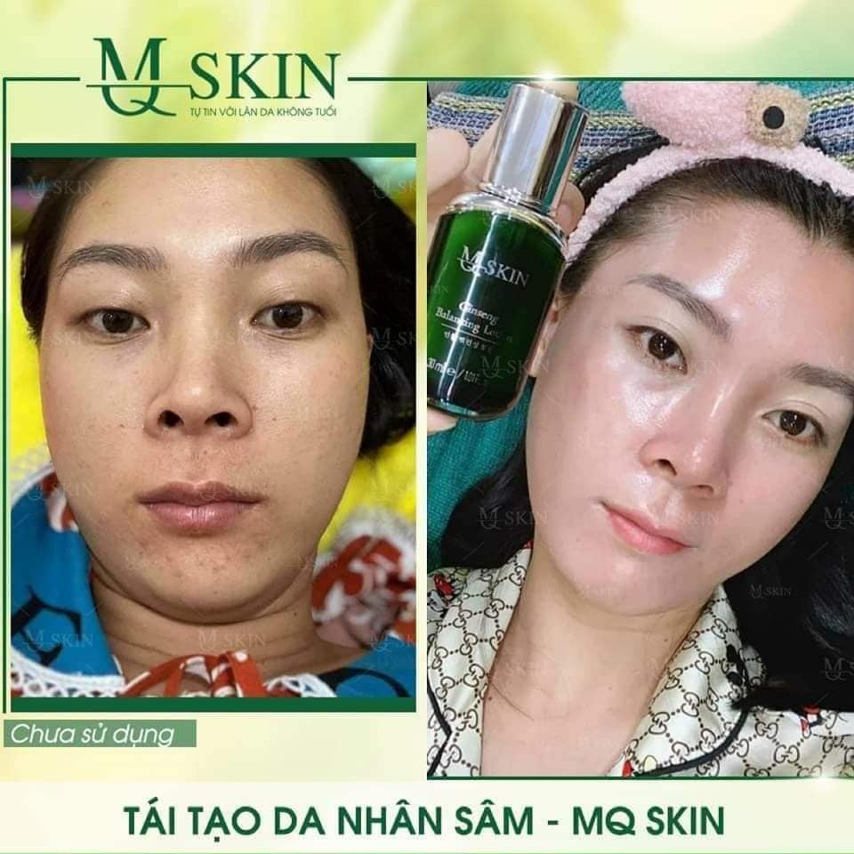 Quá trình sử dụng Kem BB Cream thay da nhân sâm MQSkin Quá trình sử dụng Kem BB Cream thay da nhân sâm MQSkin