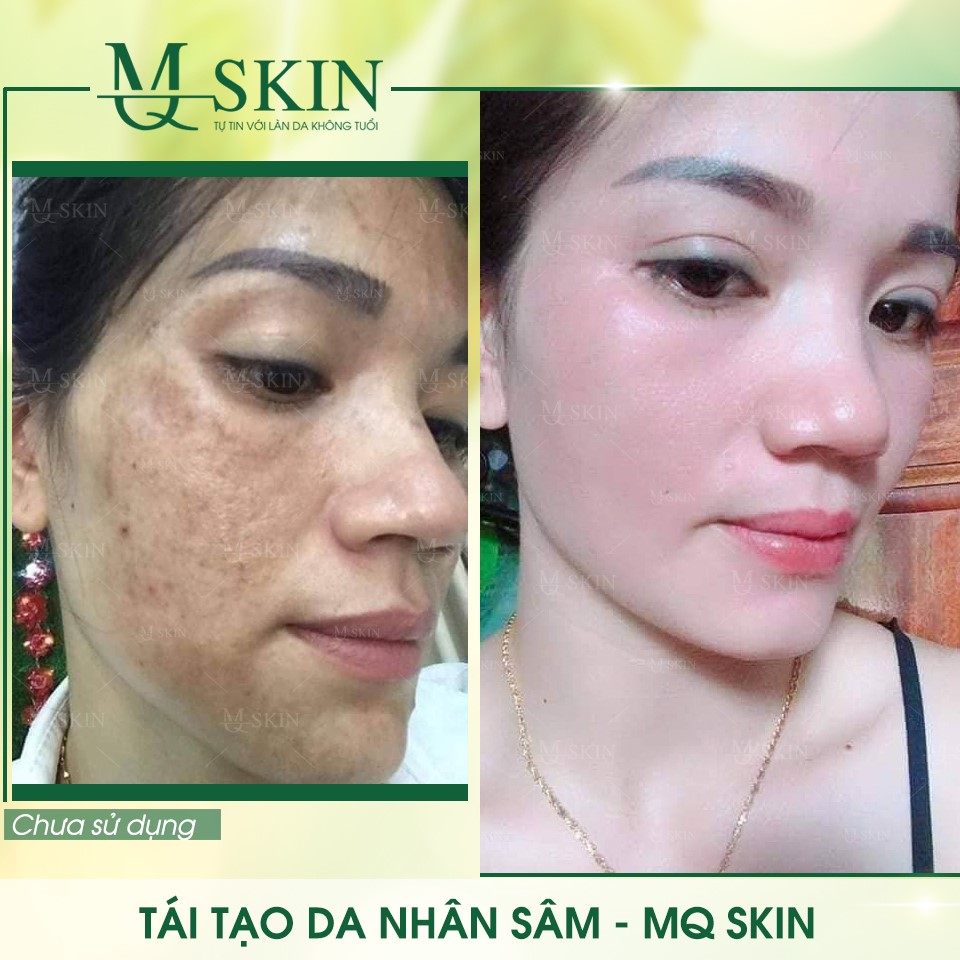Vì sao "BB Cream tái tạo da MQ Skin" gây siêu bão trên thị trường? Vì sao "BB Cream tái tạo da MQ Skin" gây siêu bão trên thị trường?