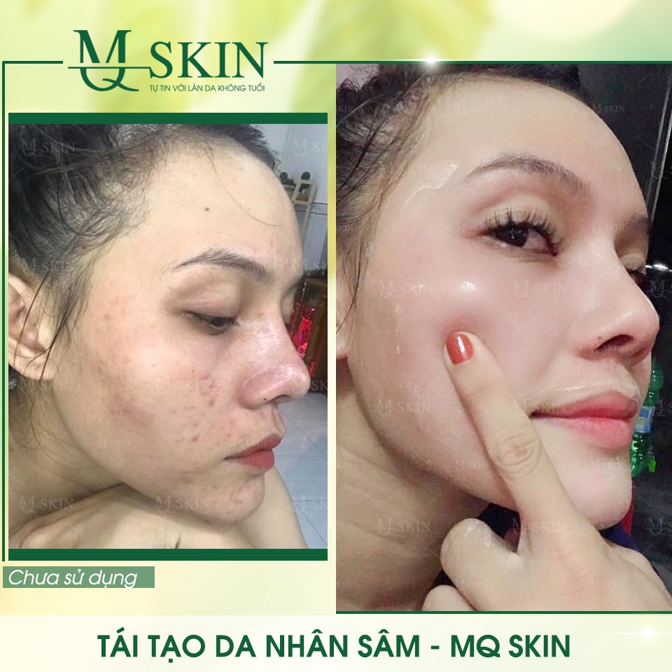 Vì sao "BB Cream tái tạo da MQ Skin" gây siêu bão trên thị trường? Vì sao "BB Cream tái tạo da MQ Skin" gây siêu bão trên thị trường?