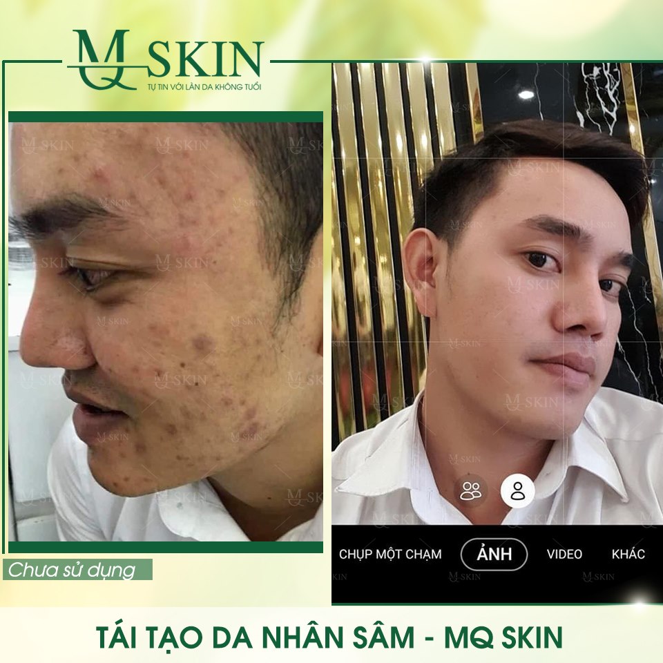 Vì sao "BB Cream tái tạo da MQ Skin" gây siêu bão trên thị trường?