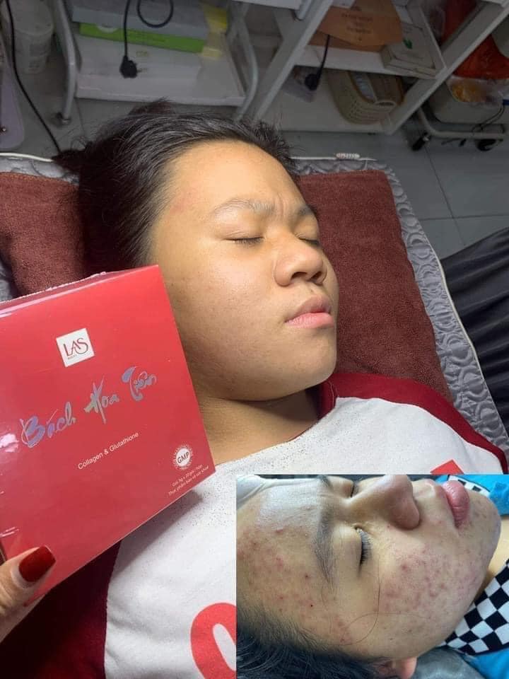 ♥️ Bách Hoa Tiên Las Beauty giúp hết khô hạn - đẹp da - tăng size vòng 1 ♥️ ♥️ Bách Hoa Tiên Las Beauty giúp hết khô hạn - đẹp da - tăng size vòng 1 ♥️