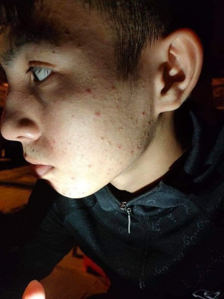 ✨✨Hồi sinh nhan sắc với thay da nhân sâm MQ Skin ✨✨Hồi sinh nhan sắc với thay da nhân sâm MQ Skin