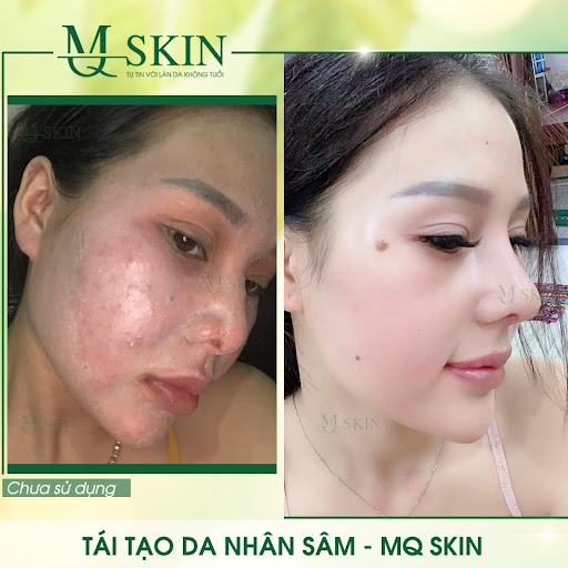 🌺🌺 Với MQ Skin đẹp chính là cách tốt nhất để bạn hạnh phúc hơn mỗi ngày🌺🌺 🌺🌺 Với MQ Skin đẹp chính là cách tốt nhất để bạn hạnh phúc hơn mỗi ngày🌺🌺