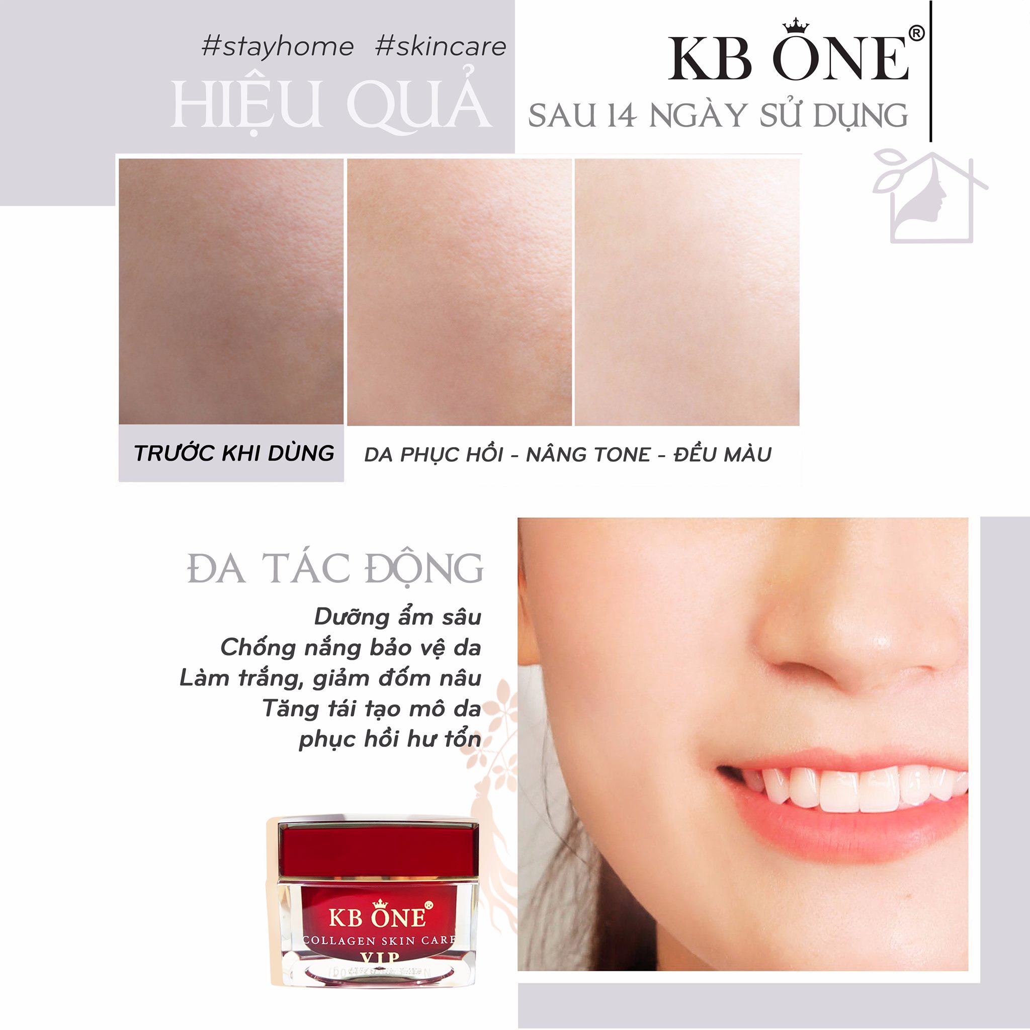 Ở nhà có kem vip đỏ, da đẹp trong tầm tay Zoley KBone Ở nhà có kem vip đỏ, da đẹp trong tầm tay Zoley KBone