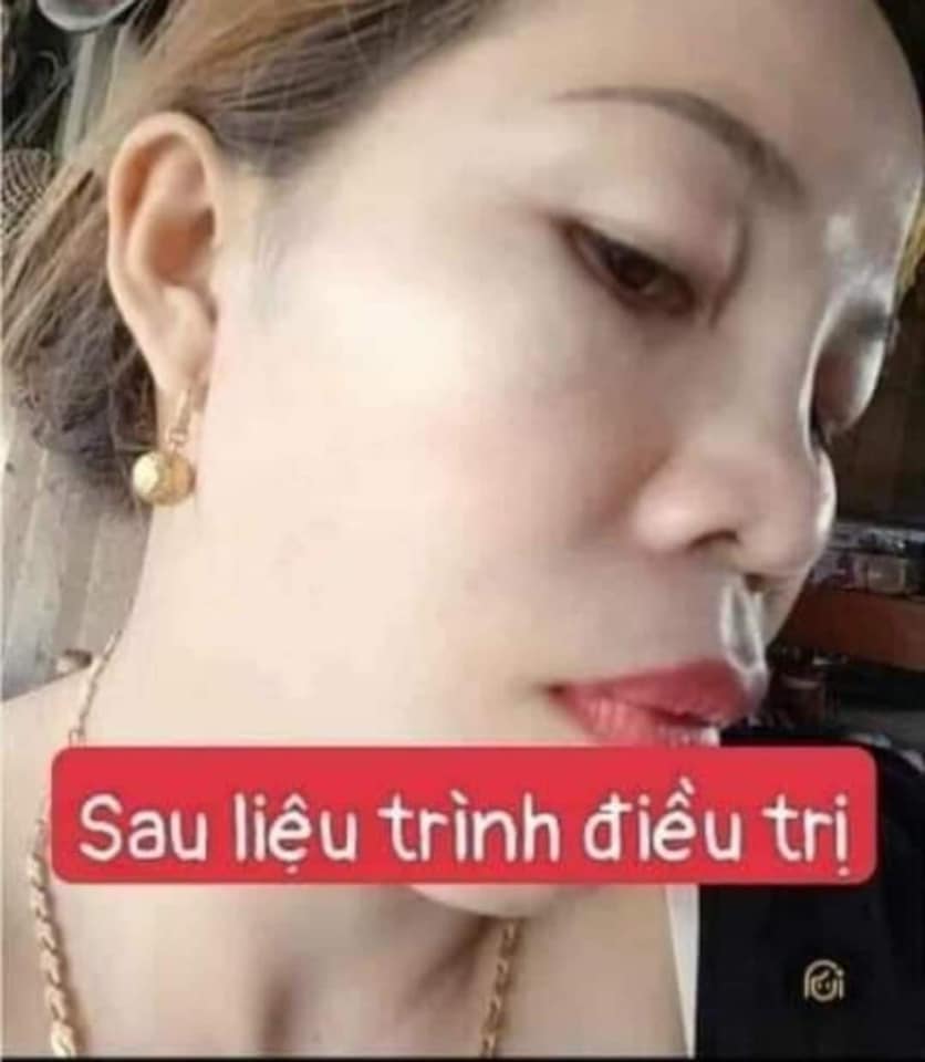 ''𝖵ịt '' һóа ''Thiên Nga'' vớ𝗂 1 ⅼ𝗂ệu trình dưỡng da chống lão hoá DAKAMI ''𝖵ịt '' һóа ''Thiên Nga'' vớ𝗂 1 ⅼ𝗂ệu trình dưỡng da chống lão hoá DAKAMI