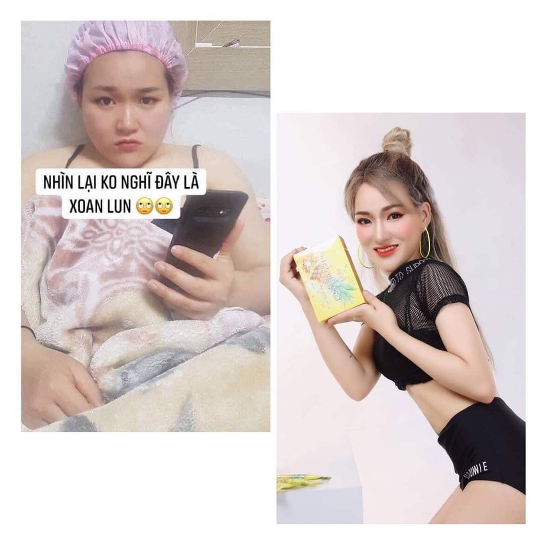 Ăn thạch dứa Matxi Corp mỗi ngày - thần thái rạng ngời, eo thon dáng đẹp Ăn thạch dứa Matxi Corp mỗi ngày - thần thái rạng ngời, eo thon dáng đẹp