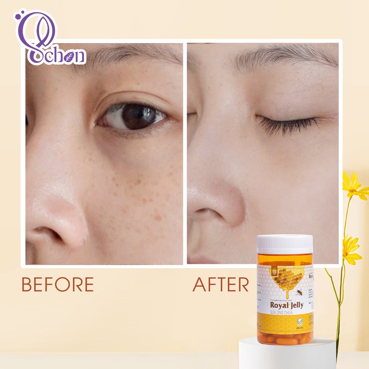 Có viên sữa ong chúa schon - tuổi tác chỉ là những con số!