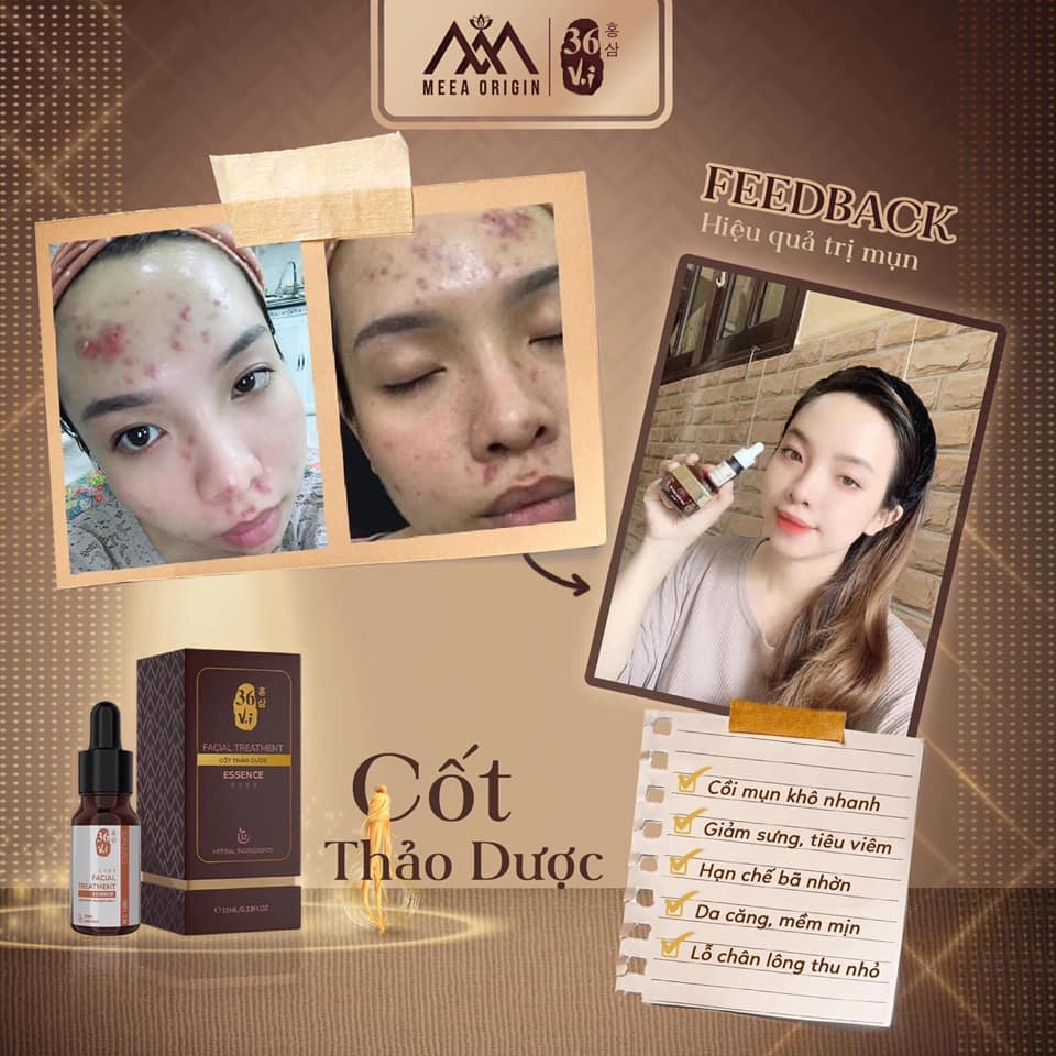 Tinh chất cốt thảo dược 36 Vị full 10ml MeeA Origin chính hãng Tinh chất cốt thảo dược 36 Vị full 10ml MeeA Origin chính hãng