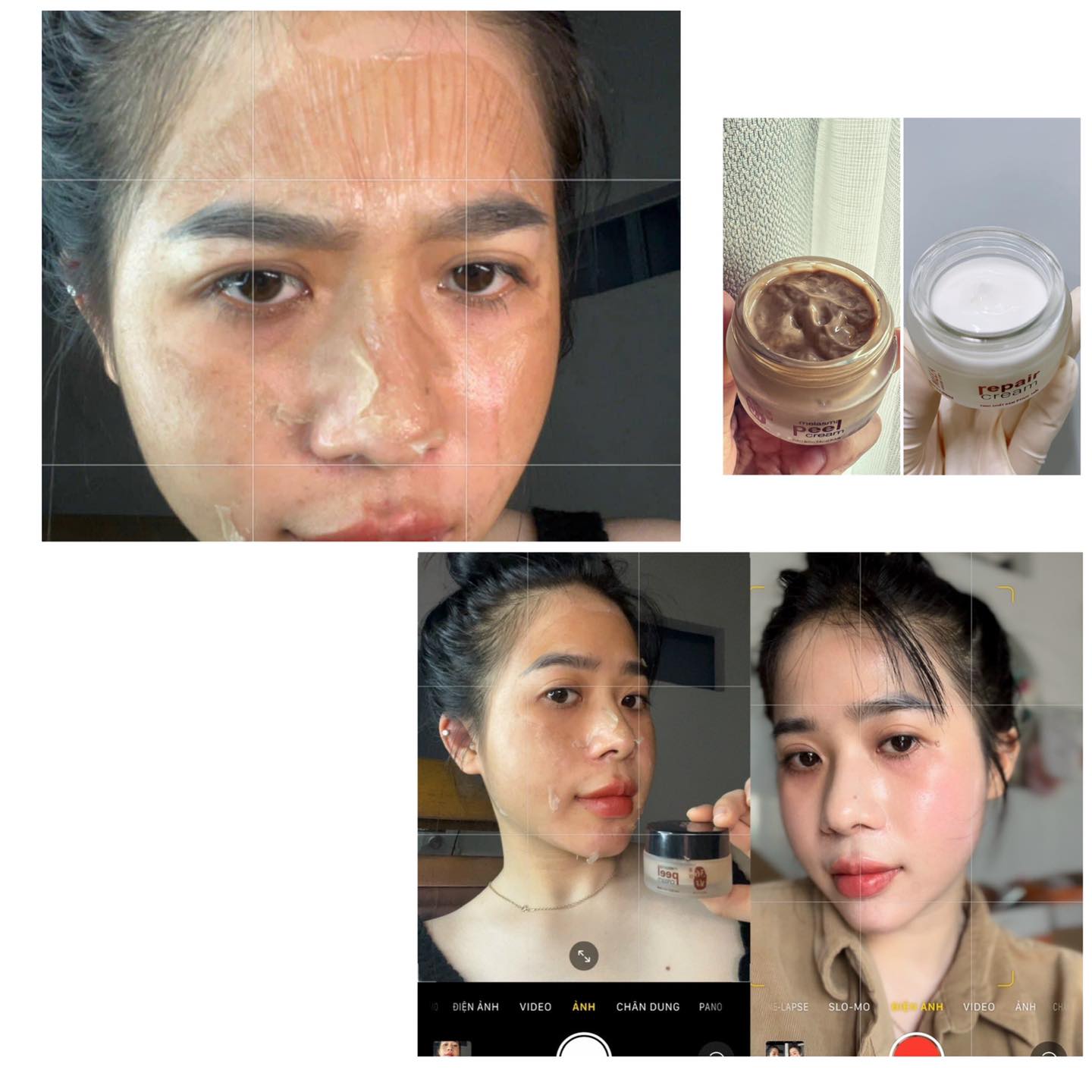 Combo vàng trong làng tái tạo da Meea Organic Combo vàng trong làng tái tạo da Meea Organic