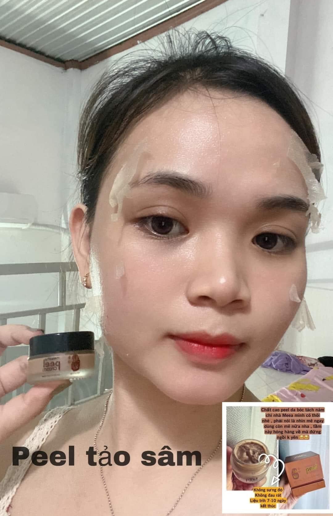 Peel da từ thiên nhiên với combo peel da Meea Organic - xu hướng của tương lai Peel da từ thiên nhiên với combo peel da Meea Organic - xu hướng của tương lai