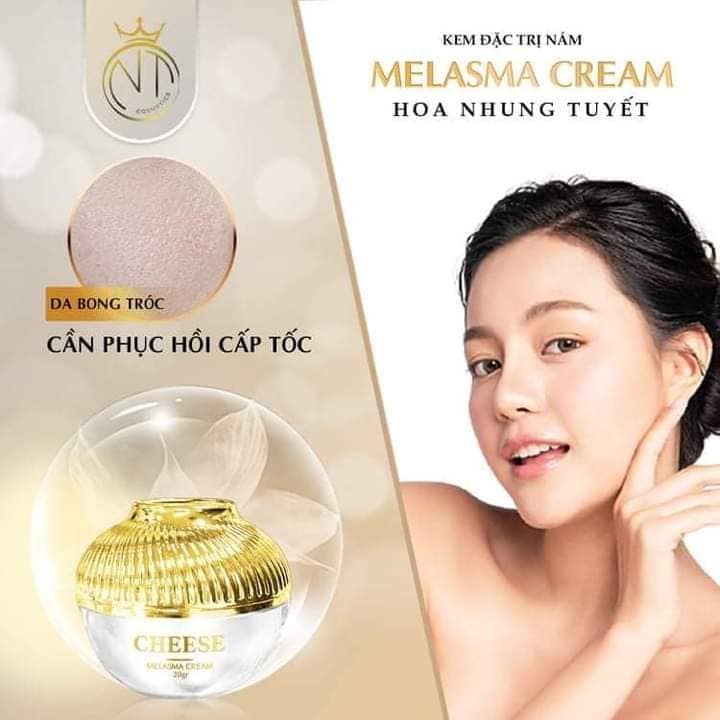 Đẩy lùi nám sạm tự tin khoe da cùng Kem đặc trị nám Cheese Melasma Cream Đẩy lùi nám sạm tự tin khoe da cùng Kem đặc trị nám Cheese Melasma Cream