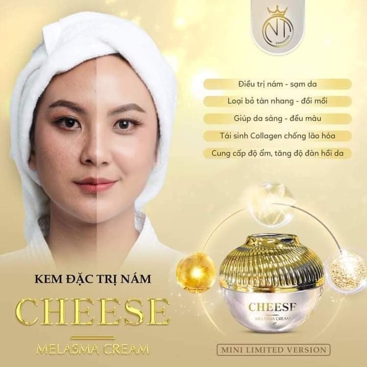 Say goodbye nám cùng kem đặc trị nám Cheese Melasma Cream Say goodbye nám cùng kem đặc trị nám Cheese Melasma Cream